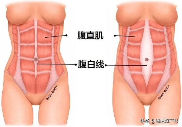 不胖卻有小肚子，當心這3個問題