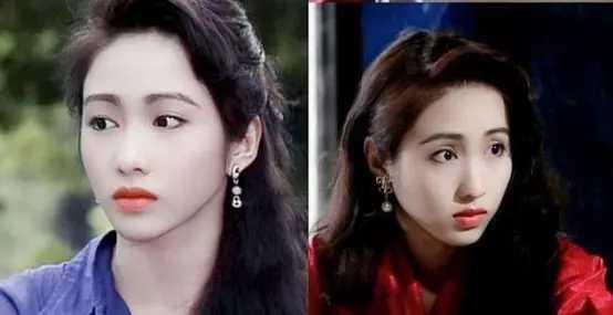 10位女星打玻尿酸前後，楊蓉、戚薇上榜，你還敢盲目“變美”嗎？