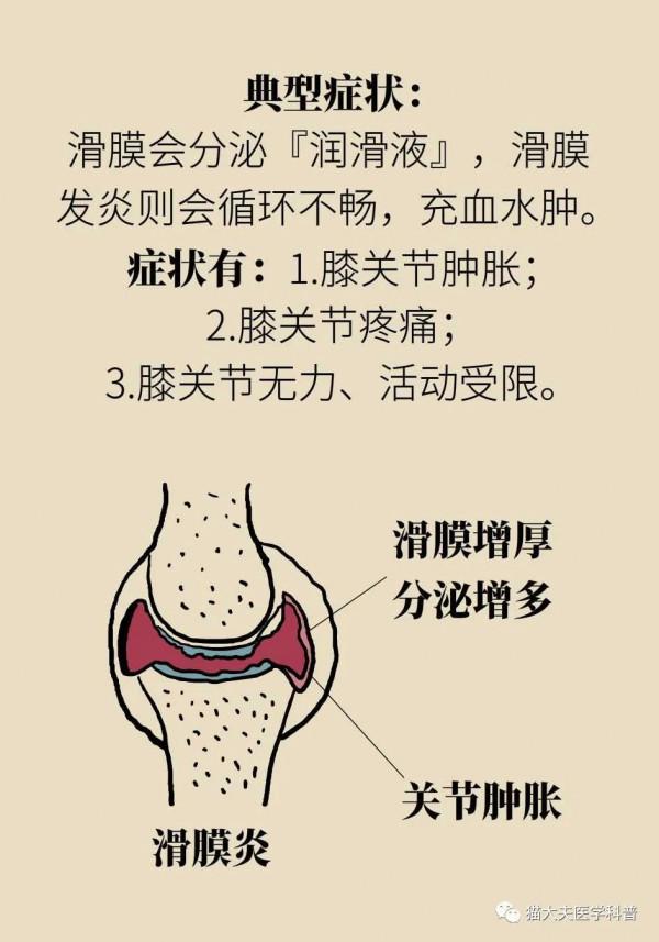 姿勢不對會引起5種損傷！你的跑步姿勢正確嗎？