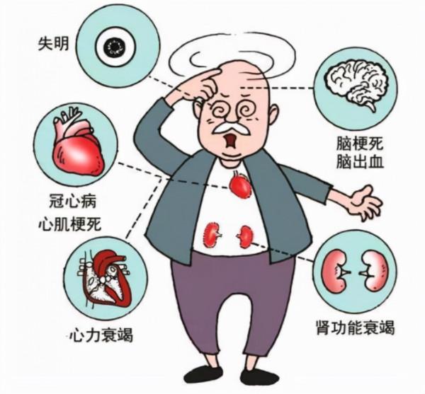 這3種降壓藥已被“淘汰”，很多患者還在吃，醫生建議及時換藥