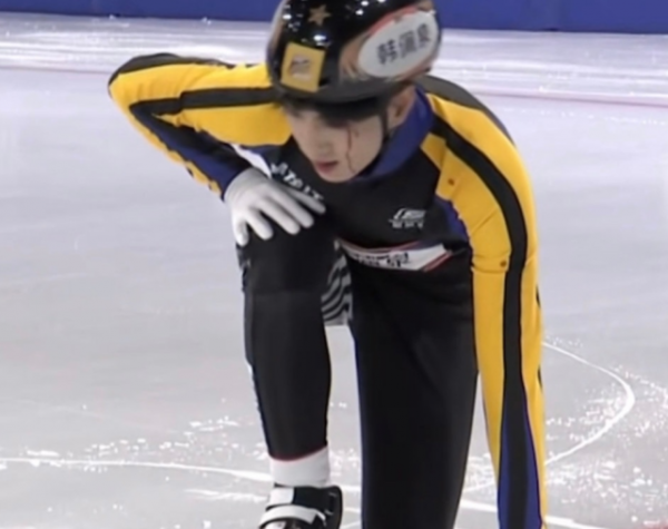 21歲男星比賽中途出現意外，摔到臉部血水往外冒，網友直呼太嚇人