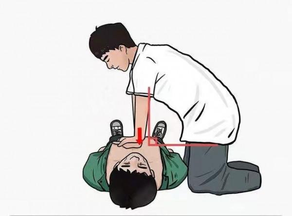 心臟驟停與心臟性猝死