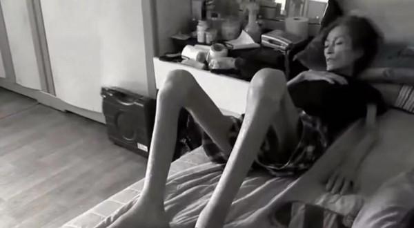 韓國女人瘦到皮包骨頭，生活無法自理，年輕時卻是大美人