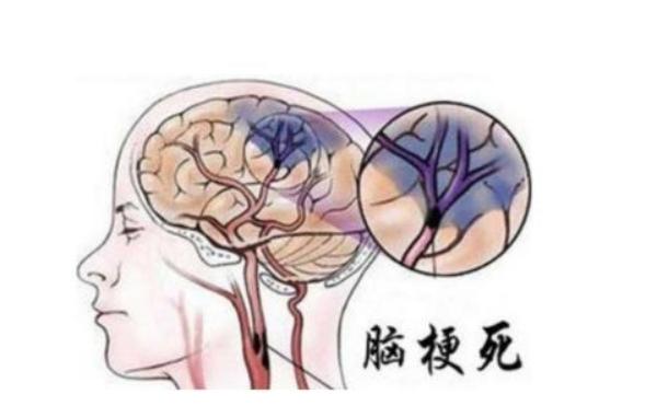 男性過了65歲後,若還能堅持做好這4件事,說明體質還不錯 男性過了65歲後,若還能堅持做好這4件事,說明體質還不錯