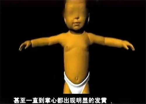 她生12個小孩全部夭折,第13個卻活了下來,如今已長大成人 她生12個小孩全部夭折,第13個卻活了下來,如今已長大成人