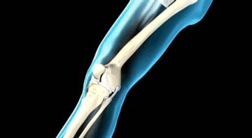 下樓梯比上樓梯輕鬆?醫生告誡膝骨關節炎患者:下樓梯更危險 下樓梯比上樓梯輕鬆?醫生告誡膝骨關節炎患者:下樓梯更危險