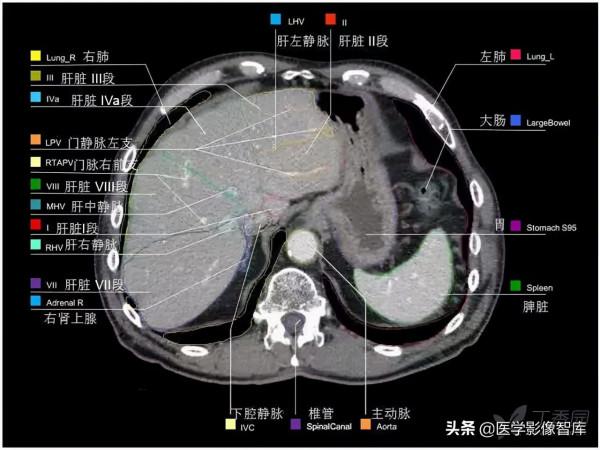 CT斷層解剖圖譜最全總結「推薦收藏」 CT斷層解剖圖譜最全總結「推薦收藏」