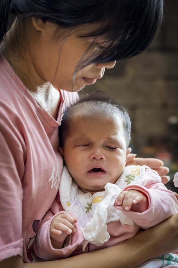 女嬰出生時體重僅3斤8兩,母親盼到孩子出院卻發現她眼睛不對勁 女嬰出生時體重僅3斤8兩,母親盼到孩子出院卻發現她眼睛不對勁