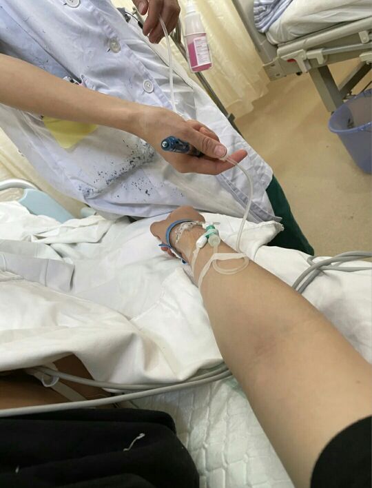 剖腹產經驗分享，這幾點真的很有必要