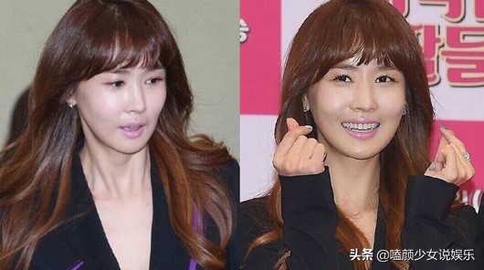 7位紅極一時的韓星今昔對比：整容臉和原裝臉20年後天壤之別