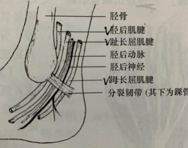 脛後神經卡壓綜合徵