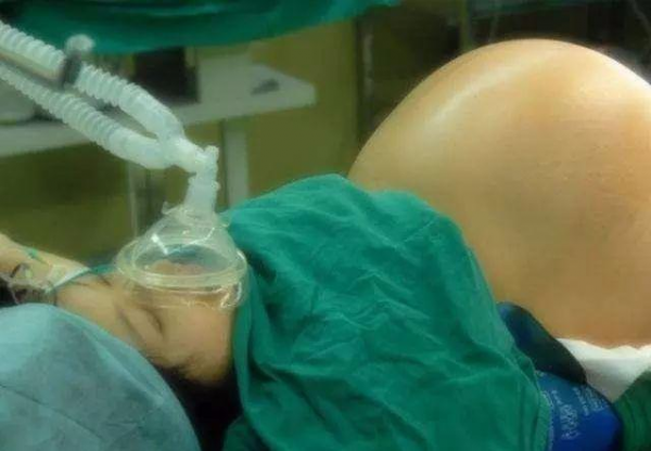 她拒絕減胎，冒著風險產下4胞胎，今全家幫忙帶娃的場景讓人羨慕