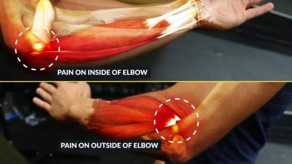 健身「肘關節」疼痛的3大常見原因、及解決方式 健身「肘關節」疼痛的3大常見原因、及解決方式