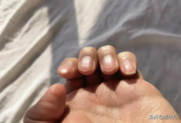身體好不好，看看指甲就知道？指甲與健康的問題，今天一次講清楚