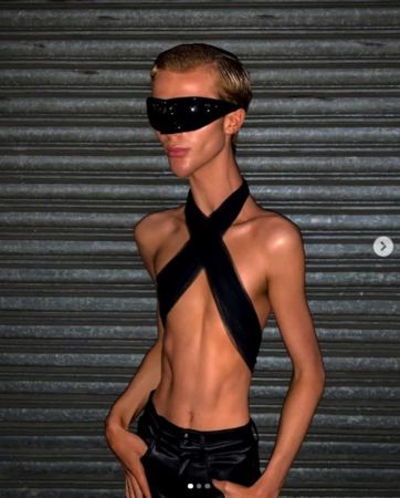 網紅減肥瘦到「骨頭清楚現形」四肢細如竹竿！對比照曝…網全嚇壞