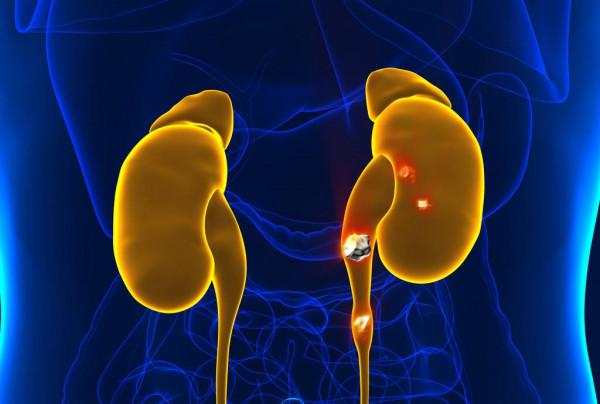 多喝水能護腎嗎?不想傷腎,就要避免錯誤的喝水方式 多喝水能護腎嗎?不想傷腎,就要避免錯誤的喝水方式