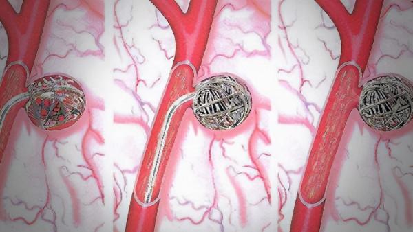 醫生眼中善良的6種“瘤”,查出來別怕,不會惡化,有的根本不是腫瘤 醫生眼中善良的6種“瘤”,查出來別怕,不會惡化,有的根本不是腫瘤