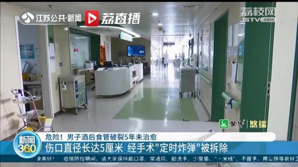 危險！男子酒後食管破裂5年未治癒 猶如“定時炸彈”