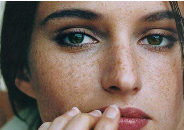 臉上“長斑”怎麼辦?這份“淡斑護膚”指南,請收好 臉上“長斑”怎麼辦?這份“淡斑護膚”指南,請收好