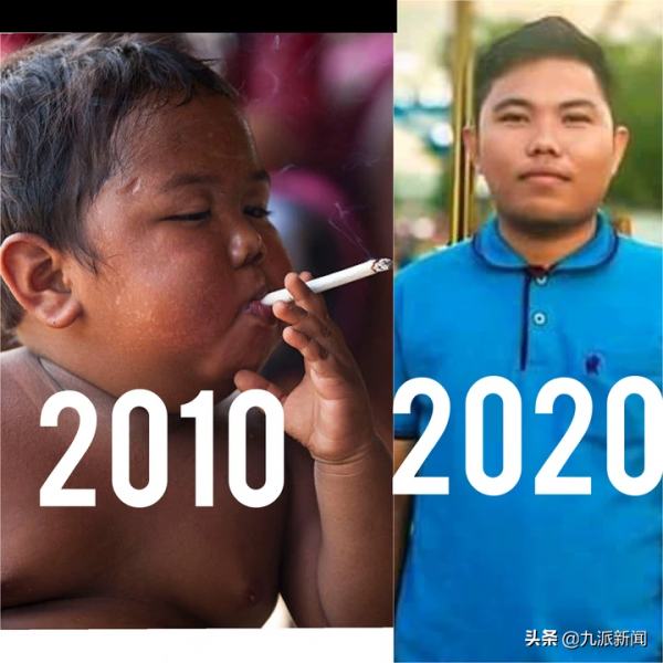 2歲成老煙槍，印尼男童曾1天抽40支菸，戒菸後身心大轉變