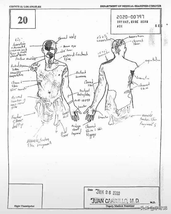 科比生命值多少錢？兩場官司接近尾聲，瓦妮莎能拿到多少賠償？