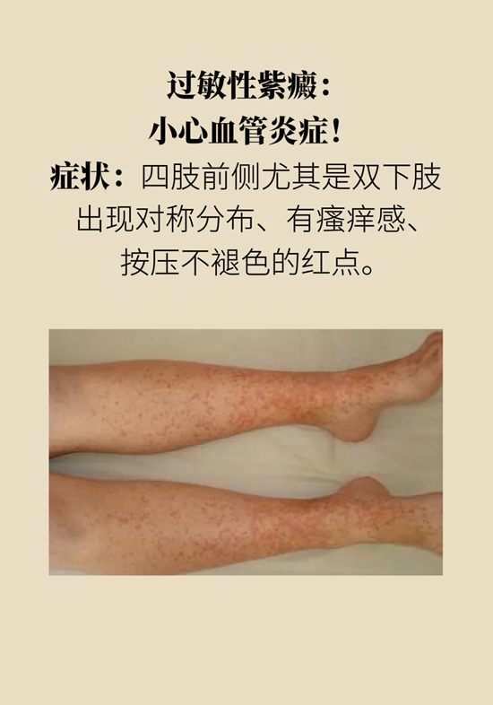 身上出現紅斑、紅點別不當回事，警惕癌變