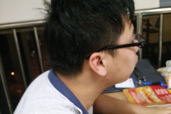 第一批用鐳射手術治近視的人，現在眼睛怎麼樣了？有後遺症嗎？