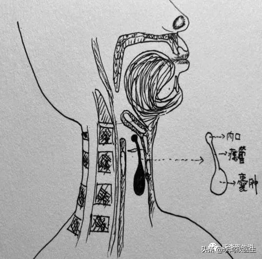 男子咽痛半年，醫生接二連三誤診，醫院：全院會診終找到病因