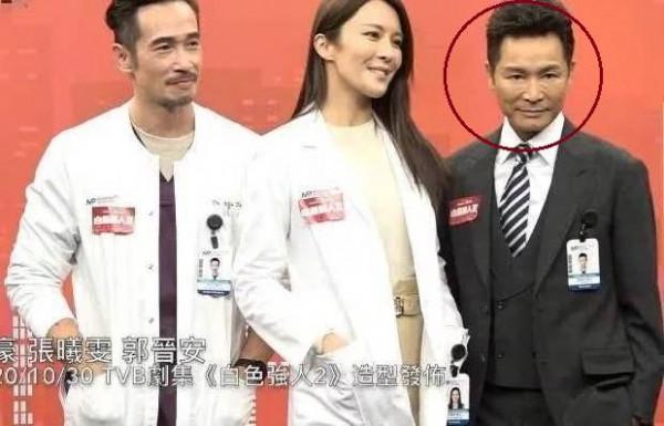 郭晉安變蠟像、陳浩民成“蛇精”，這些男星咋就想不開要去動臉呢