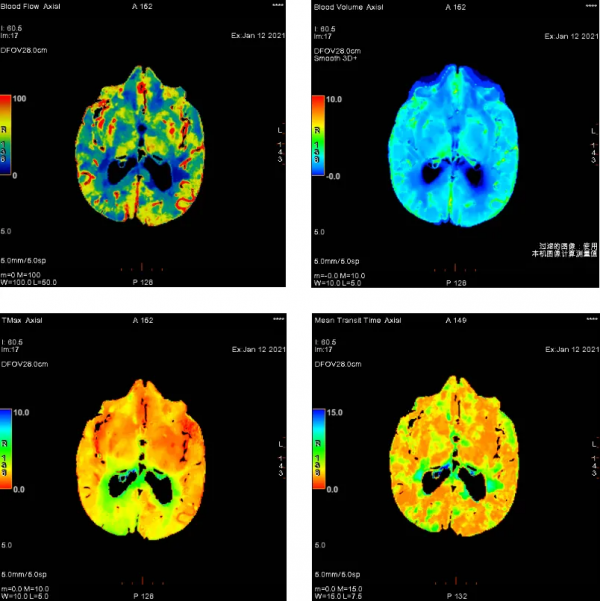 顛覆臨床醫生思維的檢查 顛覆臨床醫生思維的檢查