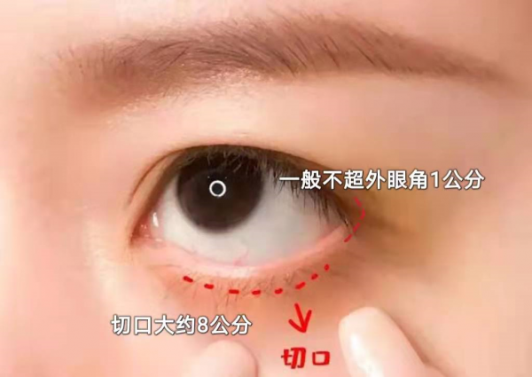 一個切口改善八個問題？快來看是什麼