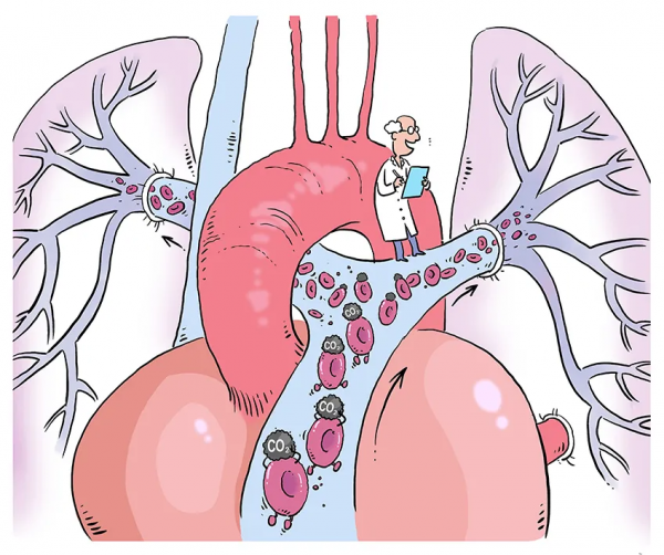 「漫繪科普」“氧氣快遞員”的人體迴圈之旅 「漫繪科普」“氧氣快遞員”的人體迴圈之旅