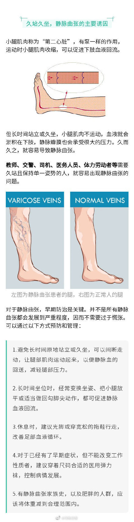 這個姿勢也許是靜脈曲張最大誘因