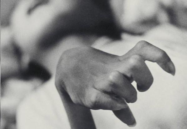 2滴“普通”的化學品濺到手套上,15秒後就宣告了她的死亡 2滴“普通”的化學品濺到手套上,15秒後就宣告了她的死亡