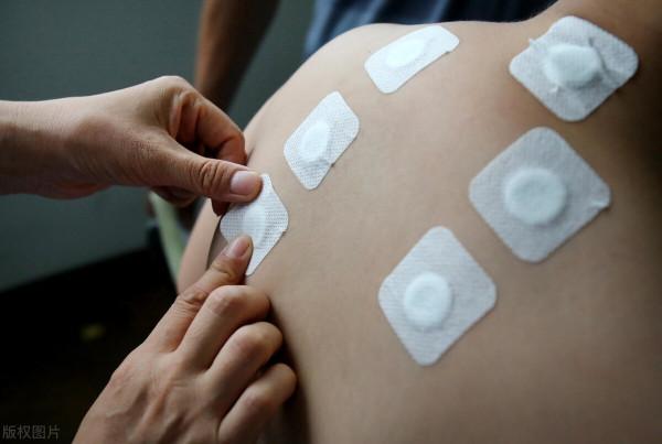 結腸炎如何治療? 結腸炎如何治療?