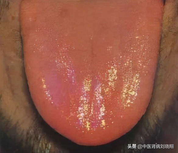 劉主任讓病人伸舌頭，看的是什麼？