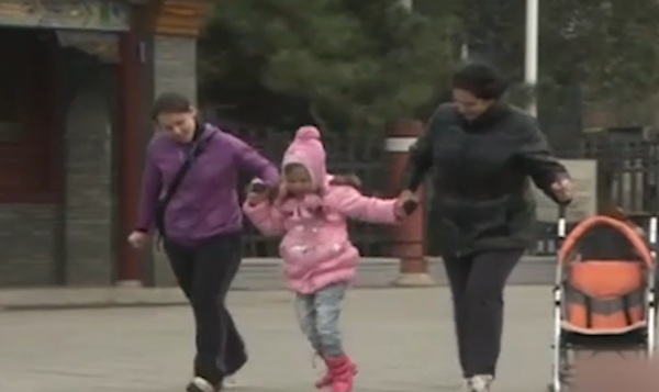 外國女孩天生雙腿畸形，頂級醫院稱無法治癒，結果被中醫3月看好