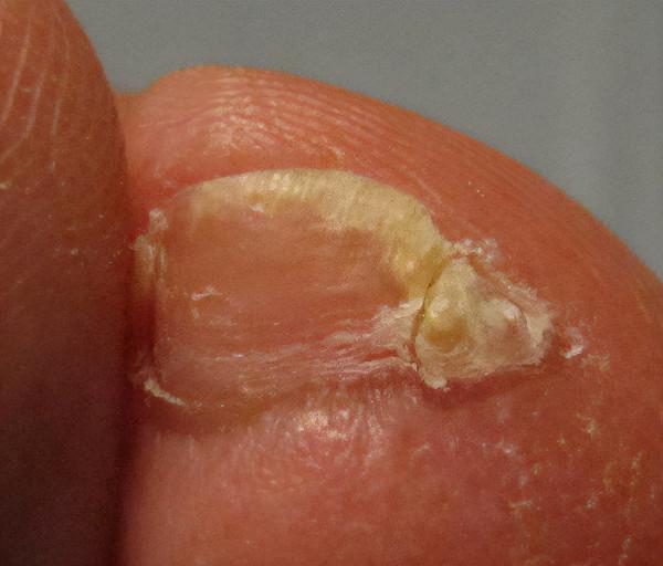 小腳趾甲長成兩瓣是啥人？據說朱元璋刀砍認親，或是純種漢人後代