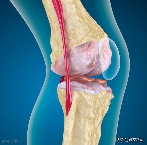 鐵與糖尿病（二）