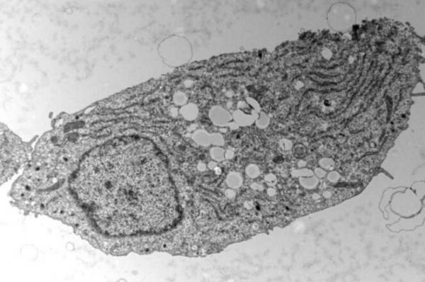 脂肪在2型糖尿病的發病過程中或會帶來意想不到的好處