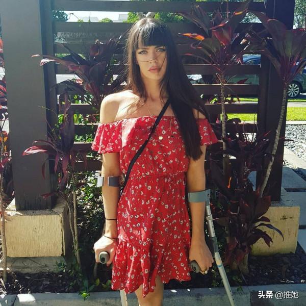 6歲被截肢，20歲被網暴，女孩兒鼓足勇氣成為內衣模特