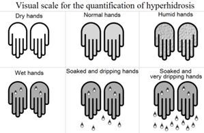 冬天孩子還是老出汗?小兒多汗看這篇就夠了 冬天孩子還是老出汗?小兒多汗看這篇就夠了