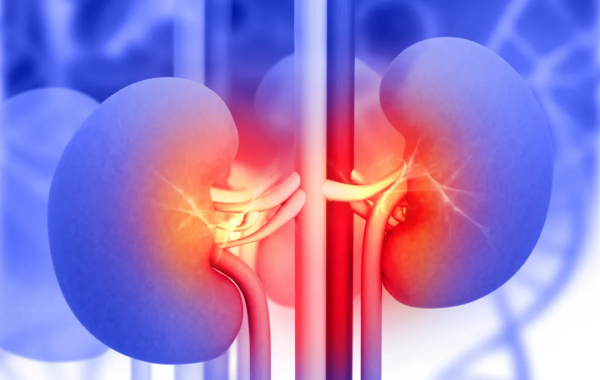 “高血壓+急性腎損傷”差點要終生透析？醫生用2個支架解決問題