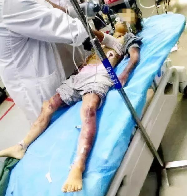 痛心,男童被父親打屁股致死!懲罰孩子,這10個方法更科學 痛心,男童被父親打屁股致死!懲罰孩子,這10個方法更科學