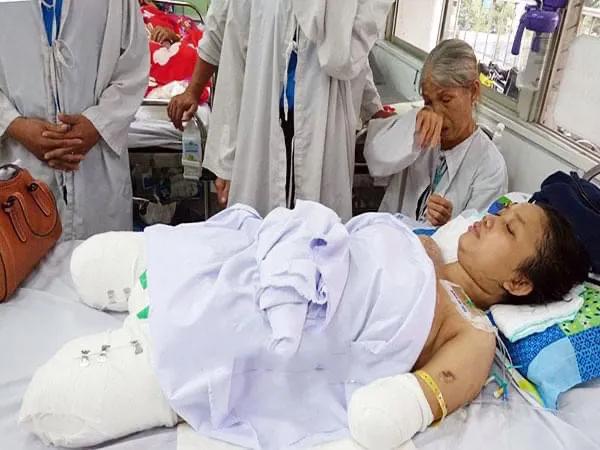 因乳腺結節截肢，越南寶媽重生：自己能掙錢，丈夫疼愛，孩子乖巧