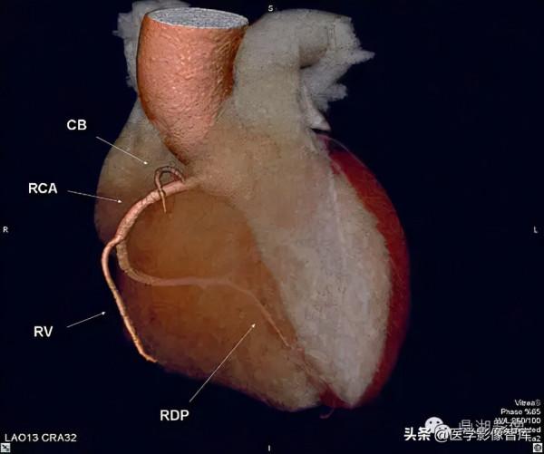 CT斷層解剖圖譜最全總結「推薦收藏」 CT斷層解剖圖譜最全總結「推薦收藏」