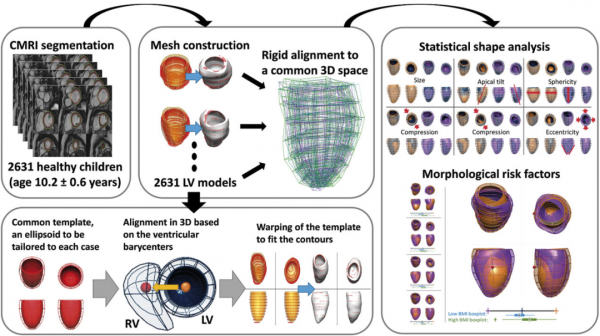 研究首次揭示肥胖對兒童心臟解剖結構的影響