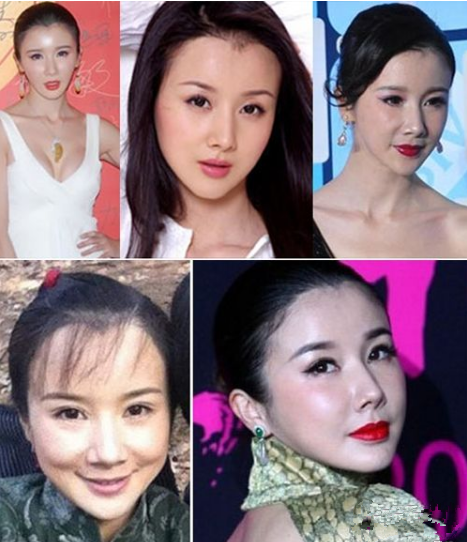 初見驚為天人,再見臉僵如石!這10位女星的臉,到底怎麼了 初見驚為天人,再見臉僵如石!這10位女星的臉,到底怎麼了