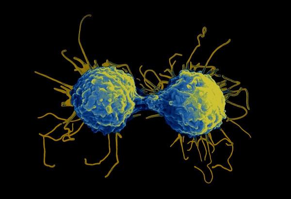 抵抗力弱?常用免疫增強劑有哪些?他們之間有何區別? 抵抗力弱?常用免疫增強劑有哪些?他們之間有何區別?