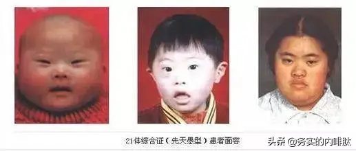 臨床基本功:一眼診病 臨床基本功:一眼診病